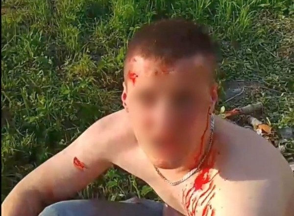 В центре Балтийска прохожие задержали окровавленного насильника В центре Балтийска прохожие задержали окровавленного насильника